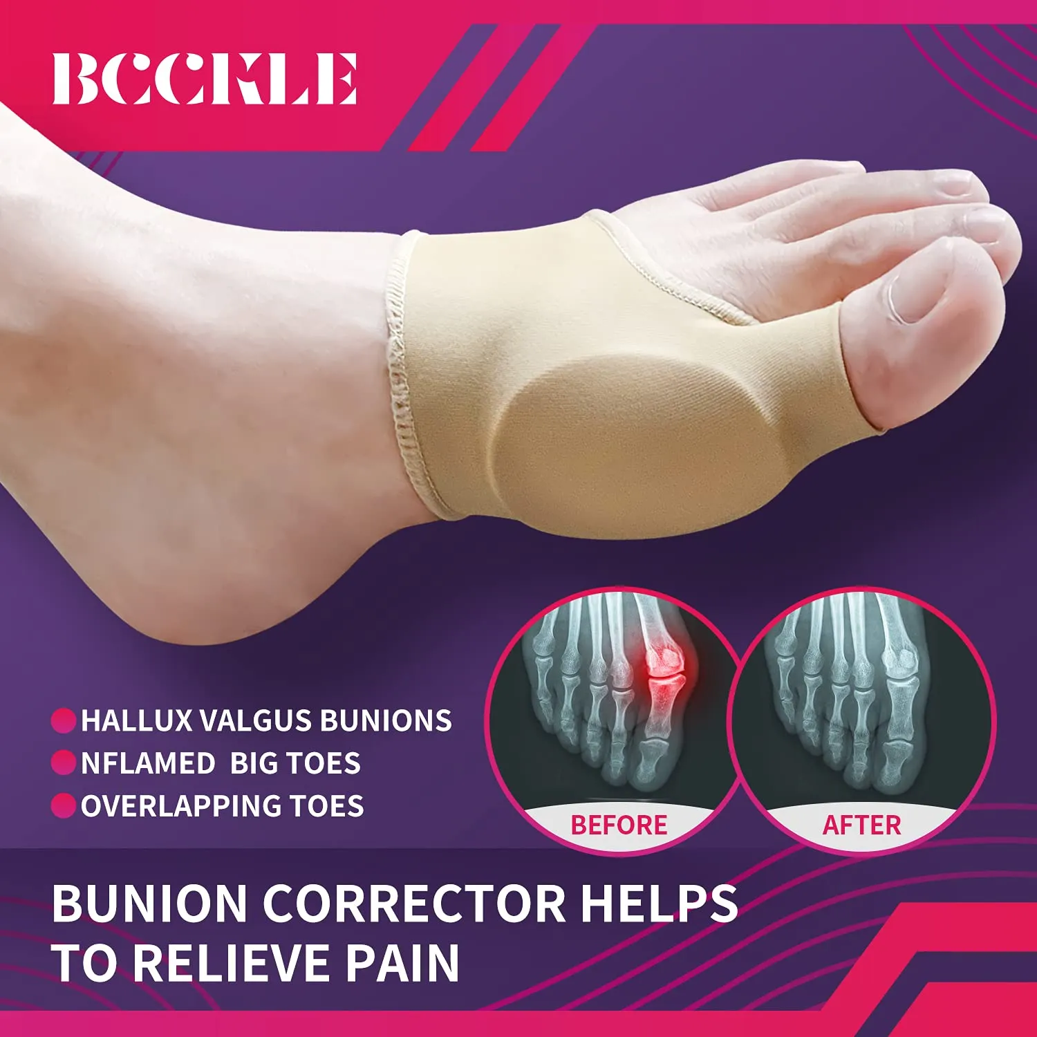 (4pcs) Bunion Relief Sleeve,Bunion Corrector with Soft Gel Pads REUSEABLE Bunion Splints Toe Spacer Socks Great for Hammer Toe,Hallux Valgus & Big Toe Joint,for Men and Women,Women10-14/Men 9-15. Women10-14/Men 9-15